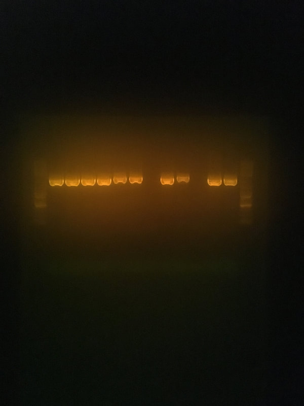 Bands of PCR products visualized on a DNA gel